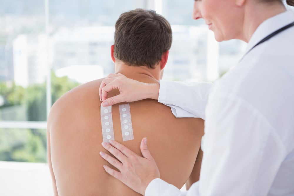 Allergy testing